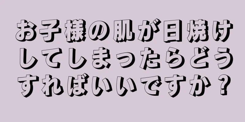 お子様の肌が日焼けしてしまったらどうすればいいですか？