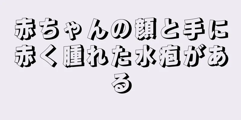 赤ちゃんの顔と手に赤く腫れた水疱がある