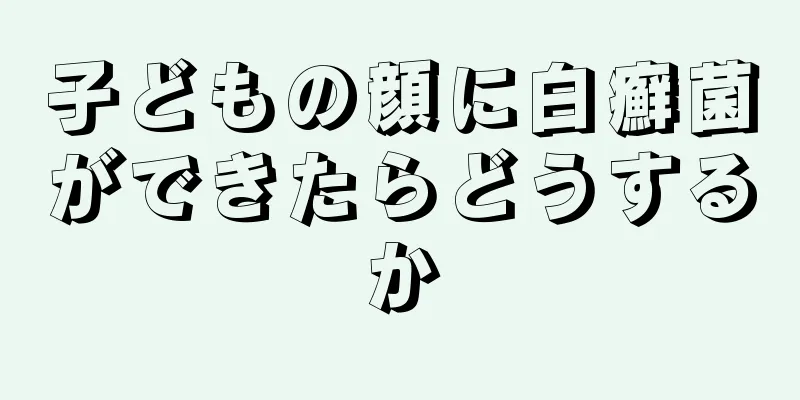 子どもの顔に白癬菌ができたらどうするか