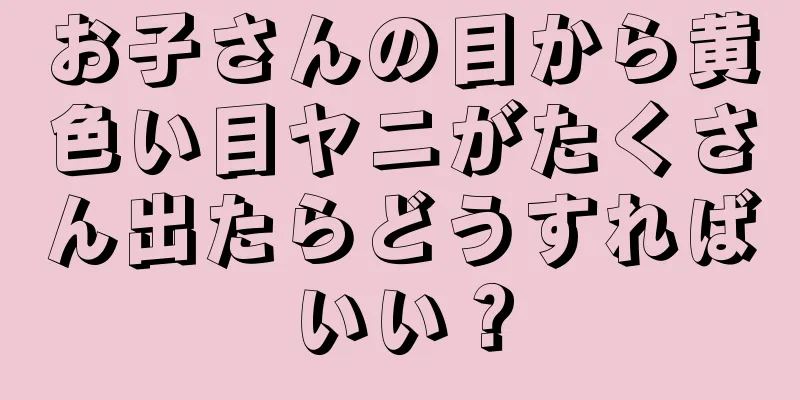 お子さんの目から黄色い目ヤニがたくさん出たらどうすればいい？