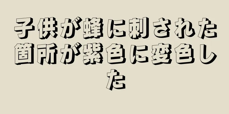 子供が蜂に刺された箇所が紫色に変色した