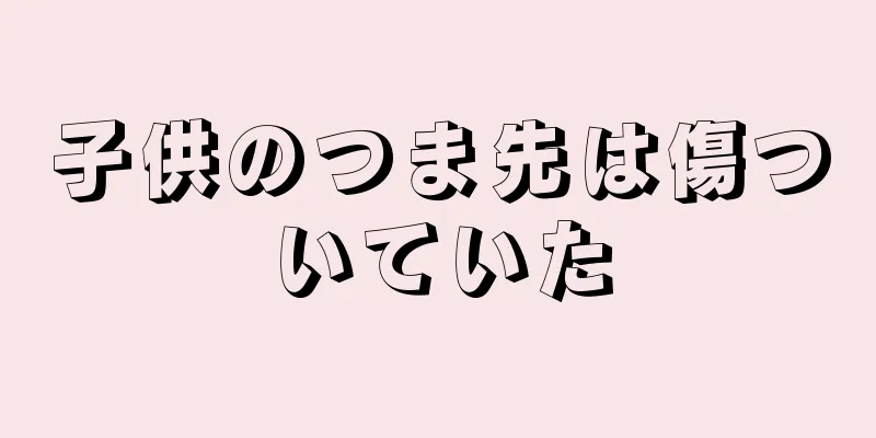子供のつま先は傷ついていた