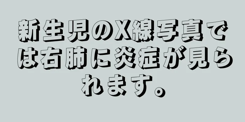 新生児のX線写真では右肺に炎症が見られます。