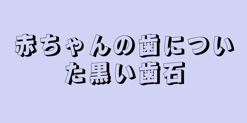 赤ちゃんの歯についた黒い歯石