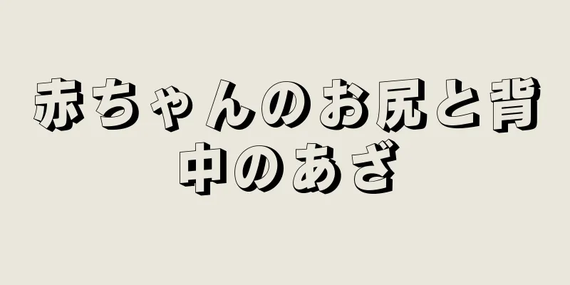 赤ちゃんのお尻と背中のあざ