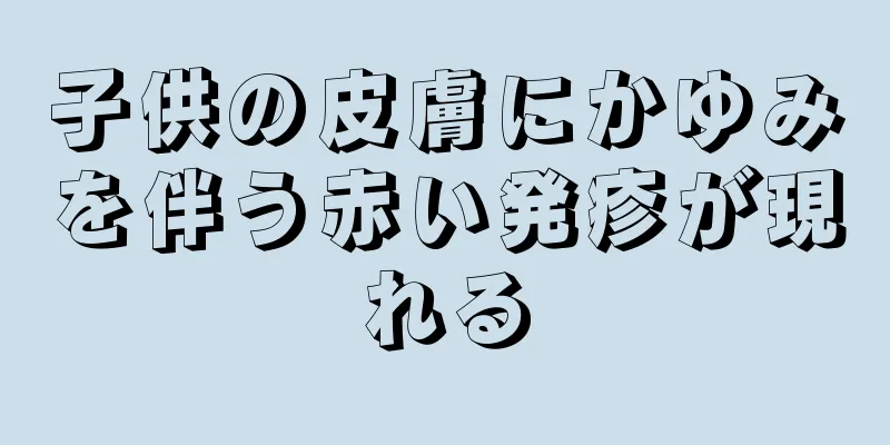 子供の皮膚にかゆみを伴う赤い発疹が現れる