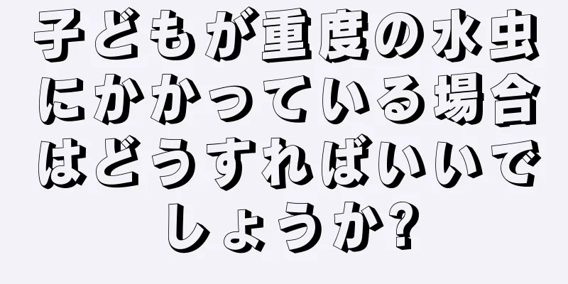 子どもが重度の水虫にかかっている場合はどうすればいいでしょうか?