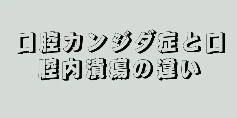 口腔カンジダ症と口腔内潰瘍の違い