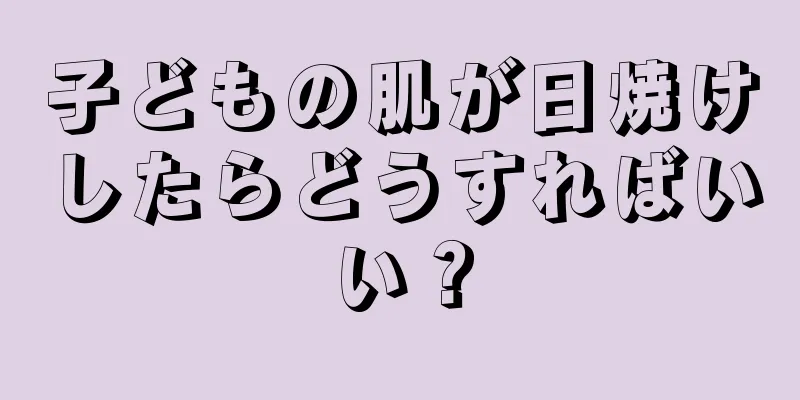 子どもの肌が日焼けしたらどうすればいい？