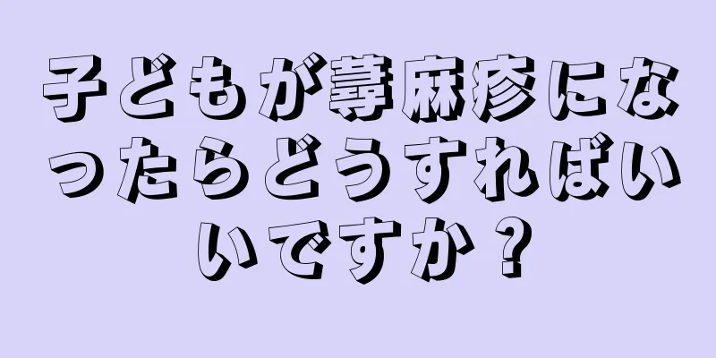 子どもが蕁麻疹になったらどうすればいいですか？