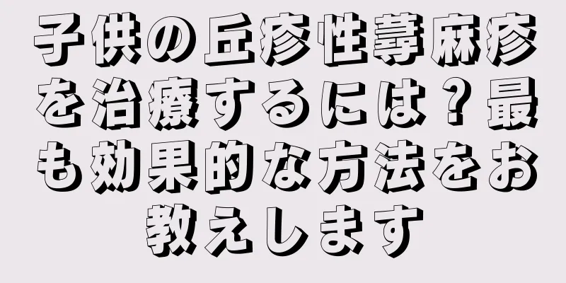 子供の丘疹性蕁麻疹を治療するには？最も効果的な方法をお教えします