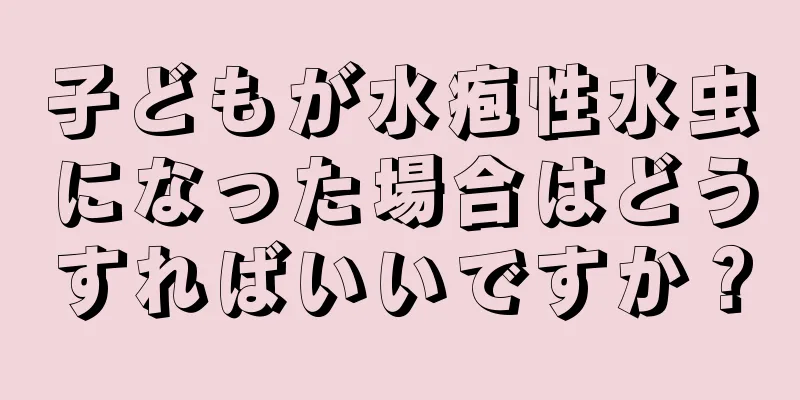 子どもが水疱性水虫になった場合はどうすればいいですか？