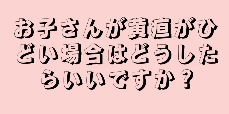 お子さんが黄疸がひどい場合はどうしたらいいですか？