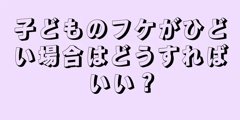 子どものフケがひどい場合はどうすればいい？